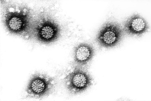 Manusa papillomavirus